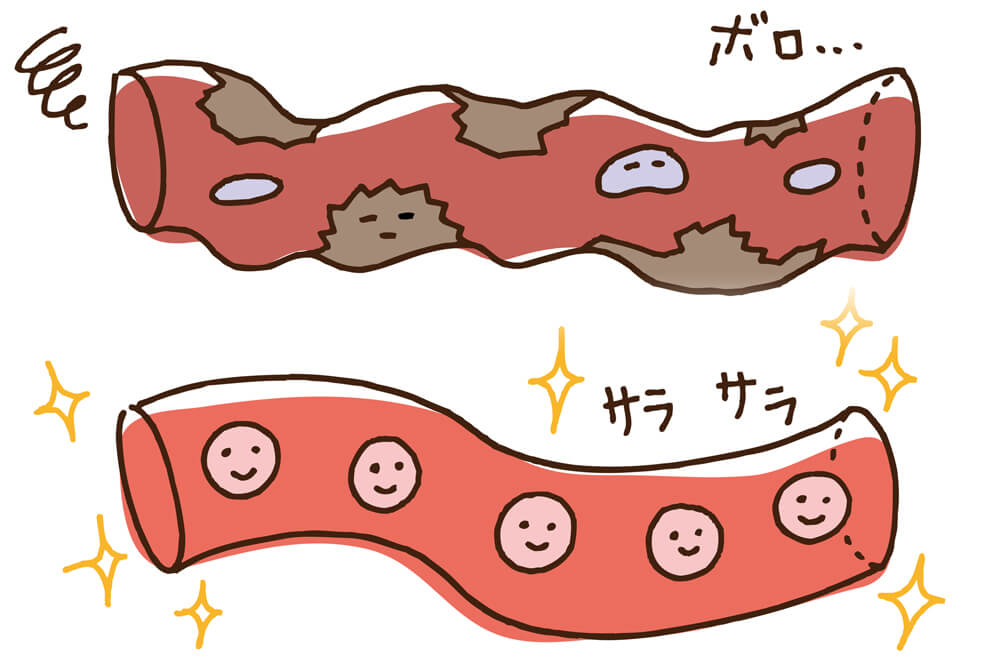 ボロボロの血管からサラサラの血管になっている様子